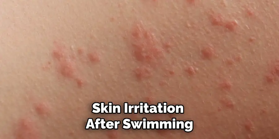 Skin Irritation After Swimming