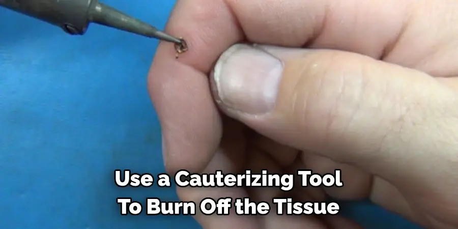 Use a Cauterizing Tool To Burn Off the Tissue